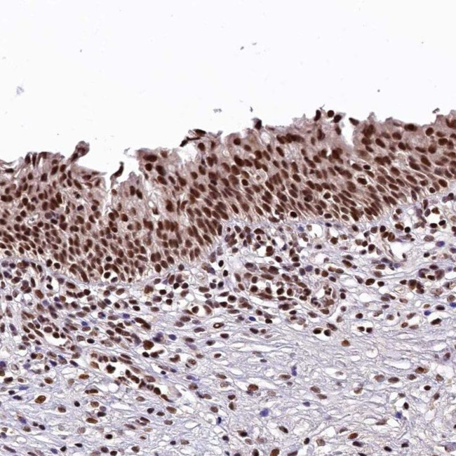 C20orf177 Antibody in Immunohistochemistry (IHC)