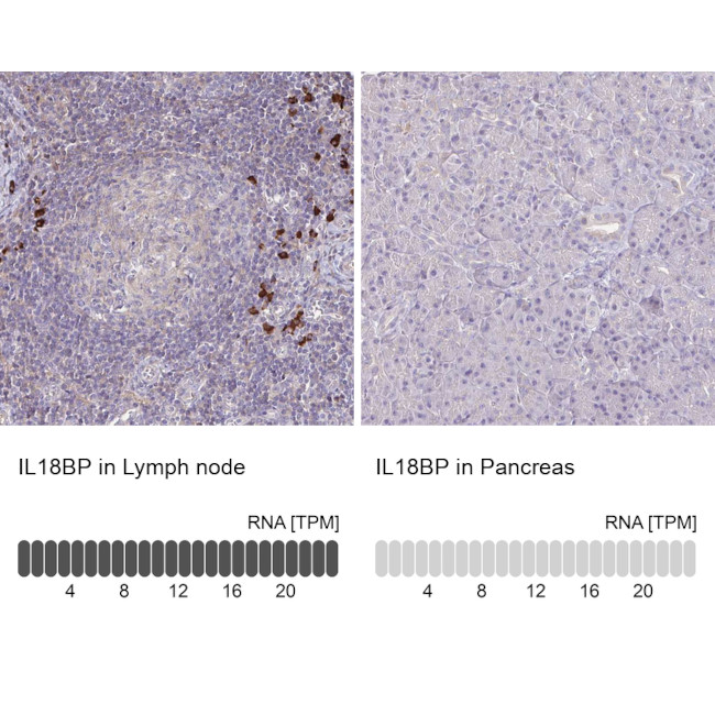 IL18BP Antibody