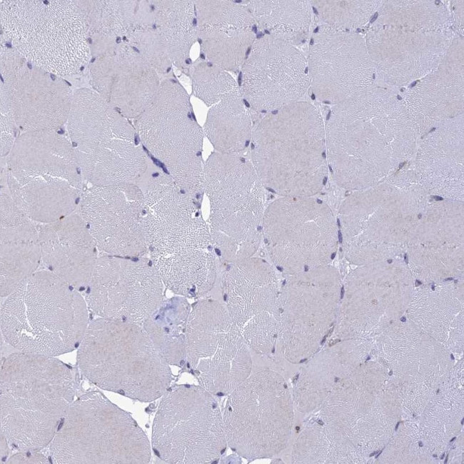 KCTD14 Antibody in Immunohistochemistry (IHC)