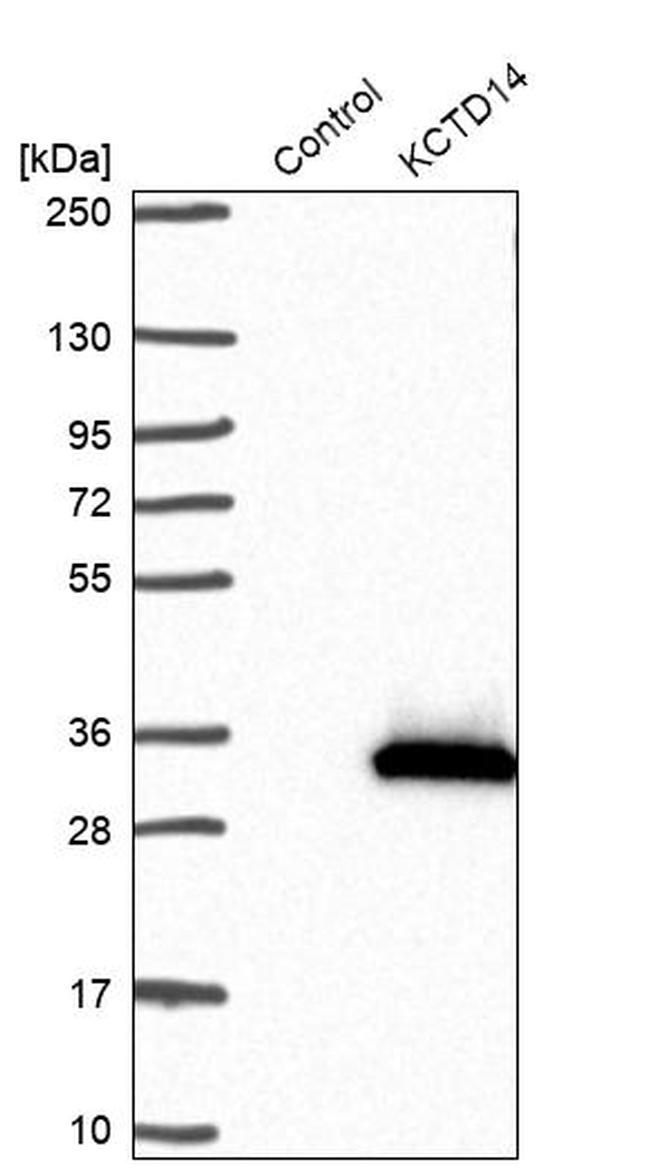 KCTD14 Antibody in Western Blot (WB)