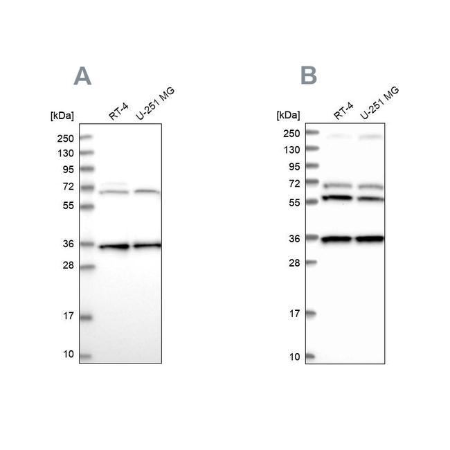 DNAJC17 Antibody in Western Blot (WB)