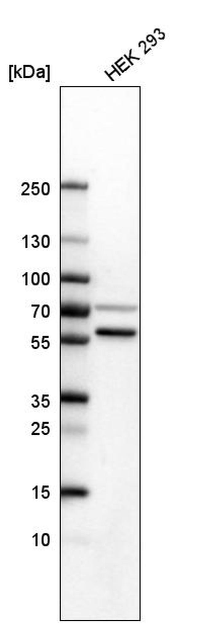 SETD6 Antibody in Western Blot (WB)