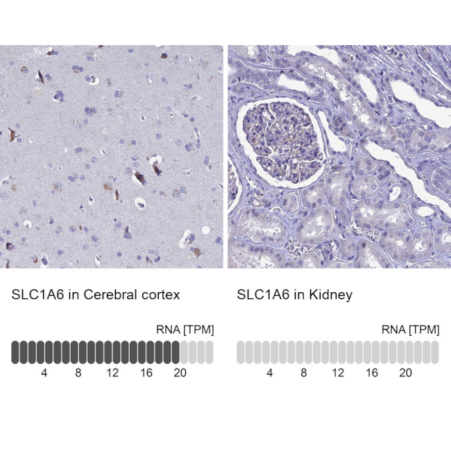 SLC1A6 Antibody in Immunohistochemistry (IHC)