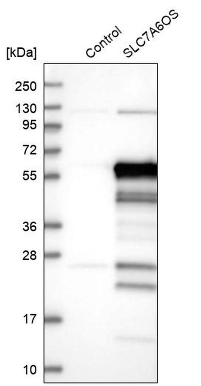 S7A6O Antibody in Western Blot (WB)