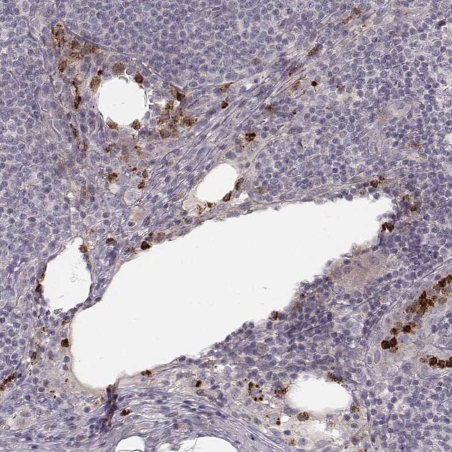 ABCA7 Antibody in Immunohistochemistry (IHC)