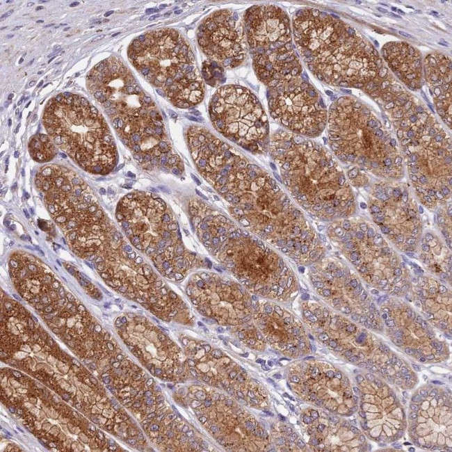 COPE Antibody in Immunohistochemistry (IHC)