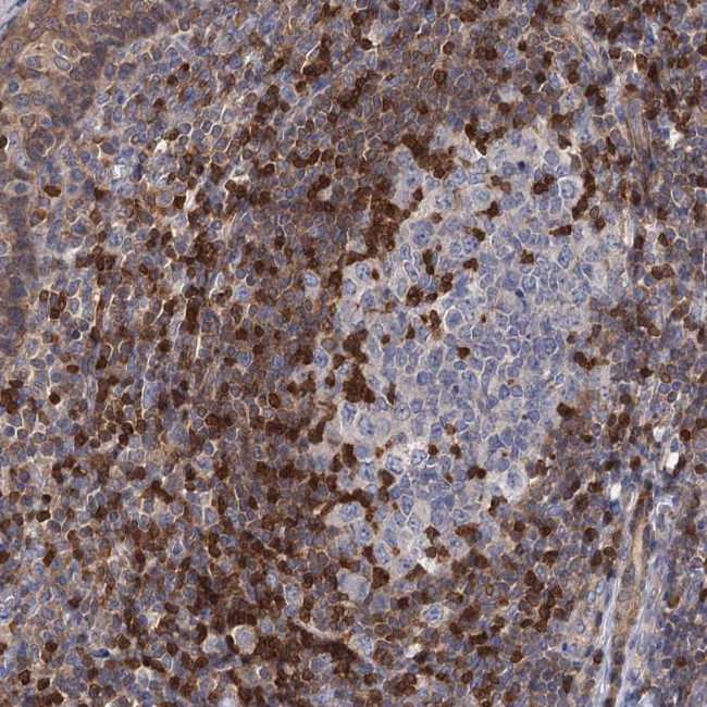 DGKA Antibody in Immunohistochemistry (IHC)