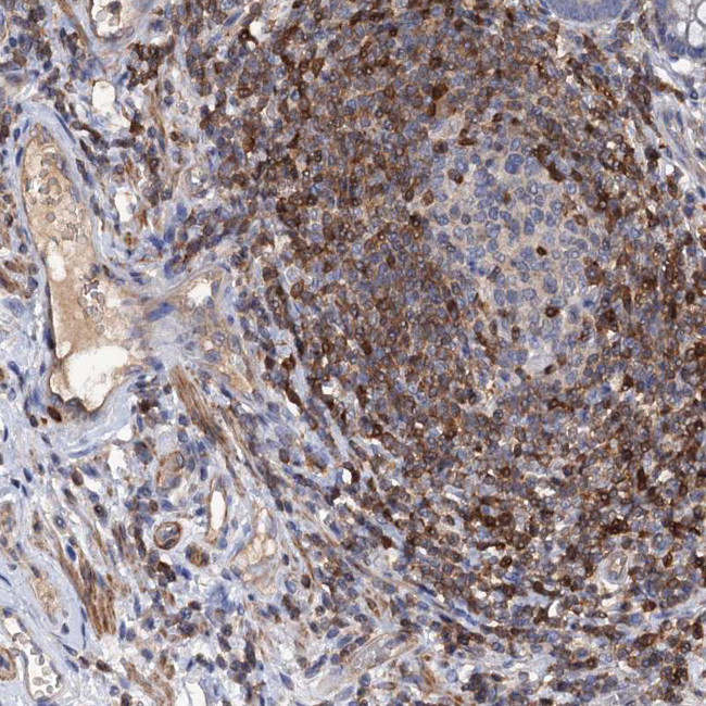 DGKA Antibody in Immunohistochemistry (IHC)