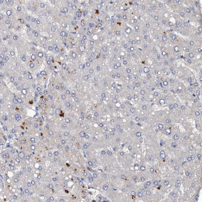 DGKA Antibody in Immunohistochemistry (IHC)