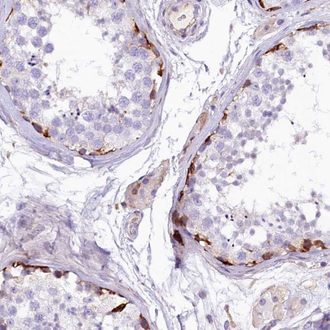 FTSJD1 Antibody in Immunohistochemistry (IHC)