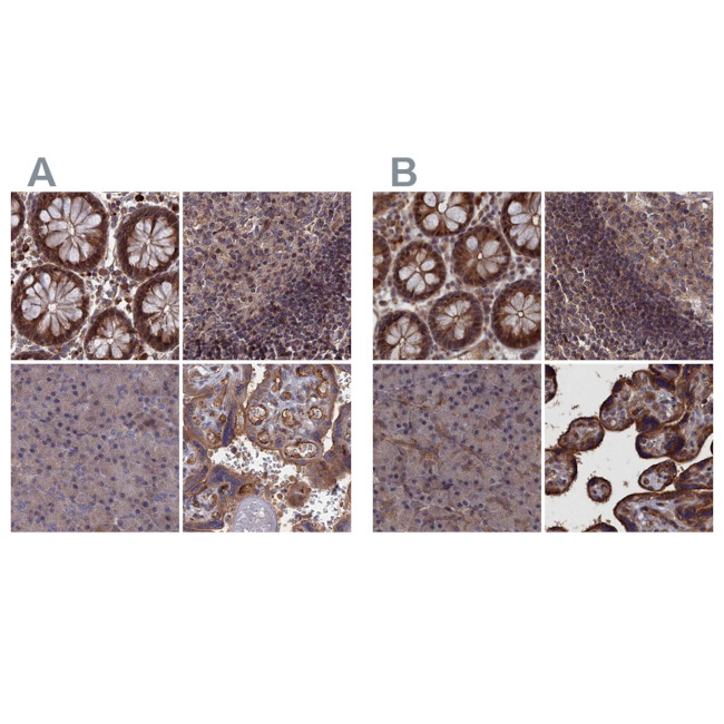 LYPLA3 Antibody in Immunohistochemistry (IHC)