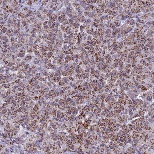 UQCRFS1 Antibody in Immunohistochemistry (IHC)