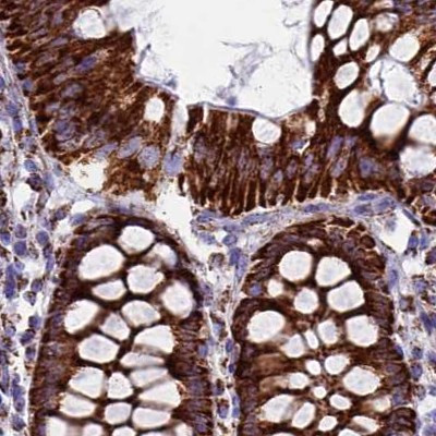 UQCRFS1 Antibody in Immunohistochemistry (IHC)