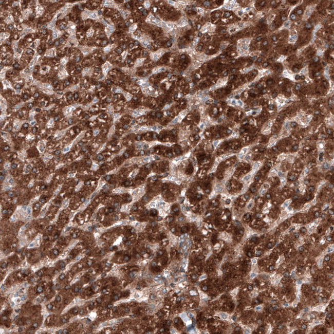 C19orf66 Antibody in Immunohistochemistry (IHC)