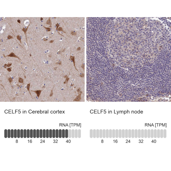 BRUNOL5 Antibody in Immunohistochemistry (IHC)