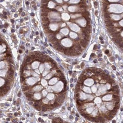 NAE1 Antibody in Immunohistochemistry (IHC)