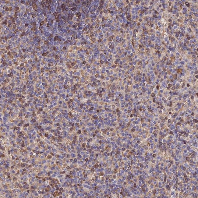 LENG8 Antibody in Immunohistochemistry (IHC)