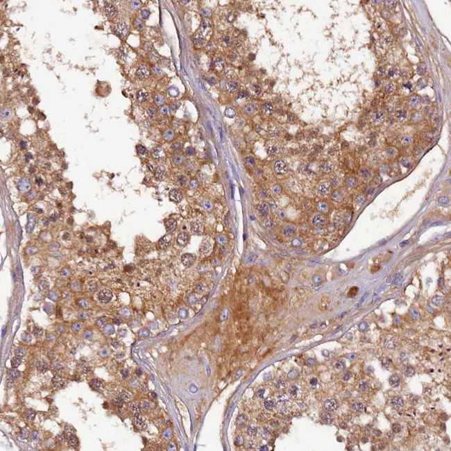 SOD3 Antibody in Immunohistochemistry (IHC)