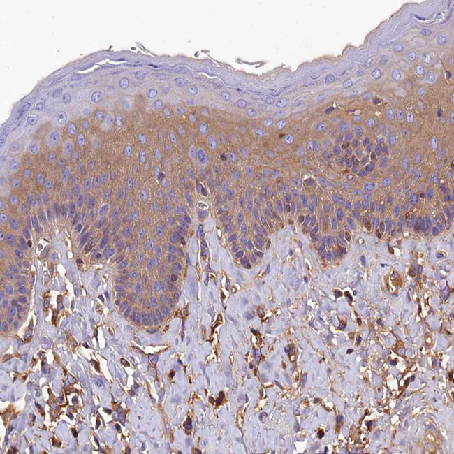 SOD3 Antibody in Immunohistochemistry (IHC)