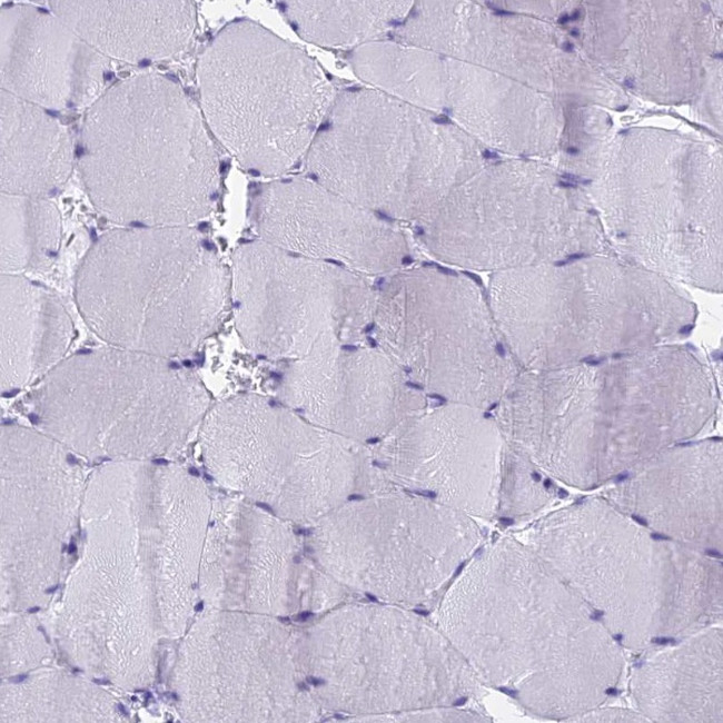 KCTD14 Antibody in Immunohistochemistry (IHC)