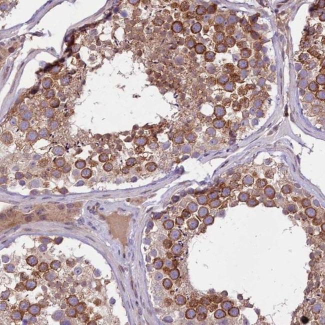 F1A alpha Antibody in Immunohistochemistry (IHC)