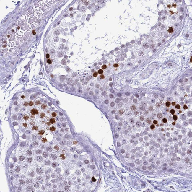 Histone H4 Antibody in Immunohistochemistry (IHC)