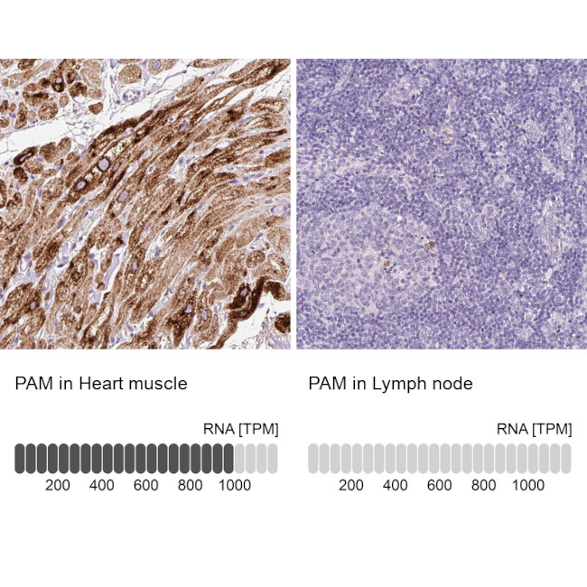 PAM Antibody in Immunohistochemistry (IHC)