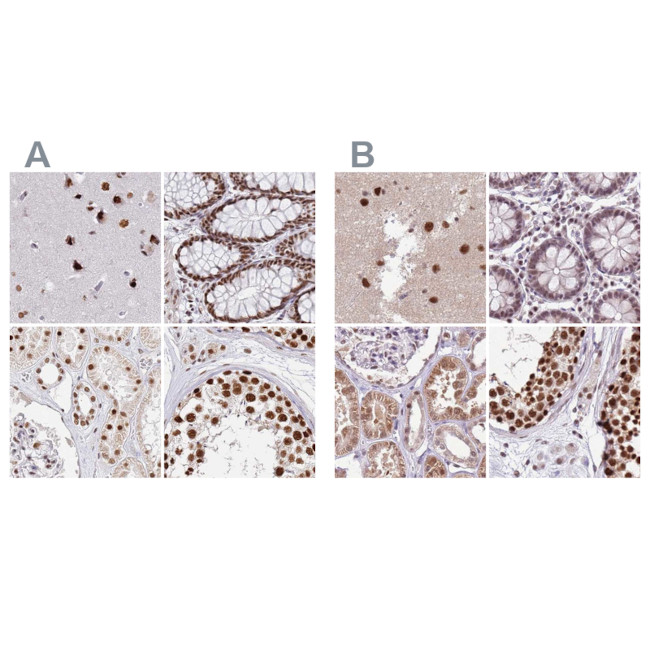 AKAP8L Antibody in Immunohistochemistry (IHC)