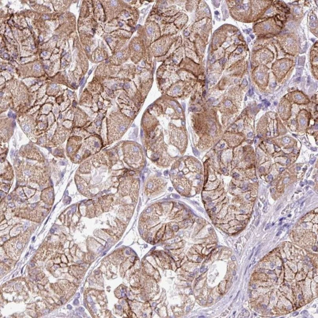 AGAP4 Antibody in Immunohistochemistry (IHC)