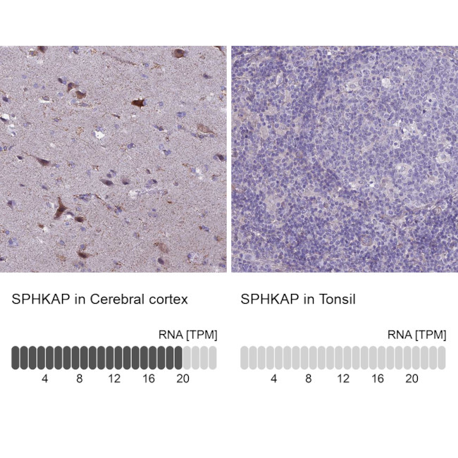 SPHKAP Antibody in Immunohistochemistry (IHC)