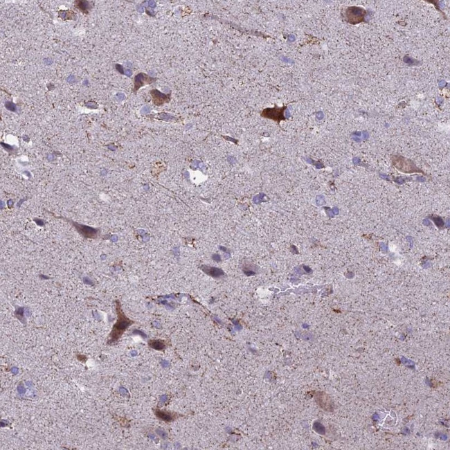 SPHKAP Antibody in Immunohistochemistry (IHC)