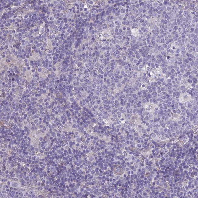 SPHKAP Antibody in Immunohistochemistry (IHC)