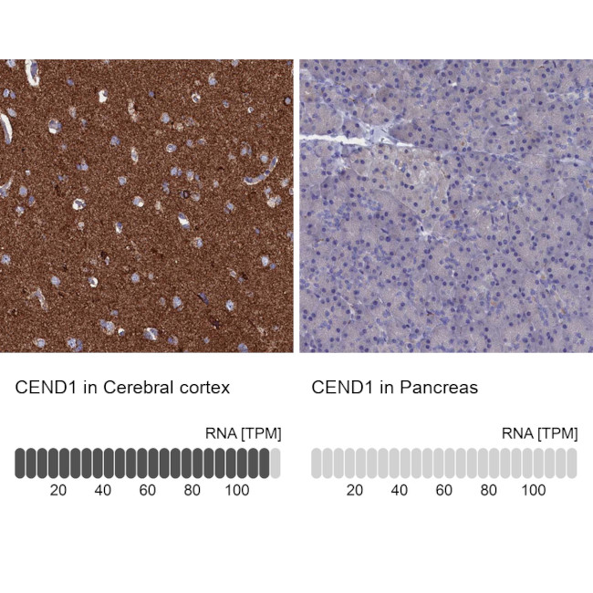 CEND Antibody in Immunohistochemistry (IHC)