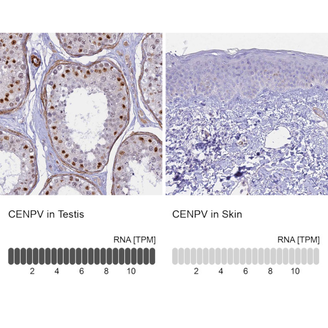 CENPV Antibody