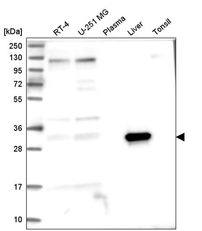 ASPDH Antibody in Western Blot (WB)