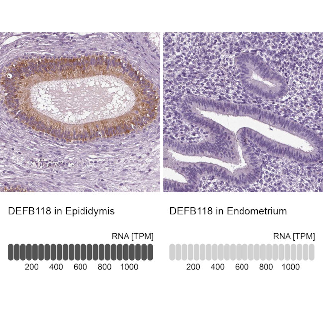 DEFB118 Antibody in Immunohistochemistry (IHC)