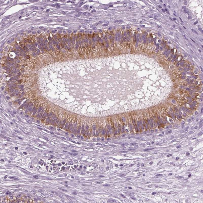 DEFB118 Antibody in Immunohistochemistry (IHC)