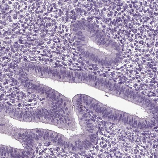 DEFB118 Antibody in Immunohistochemistry (IHC)