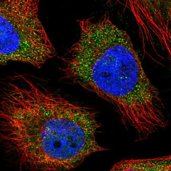 RC3H2 Antibody in Immunocytochemistry (ICC/IF)