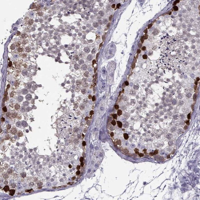 GAGE1 Antibody in Immunohistochemistry (IHC)