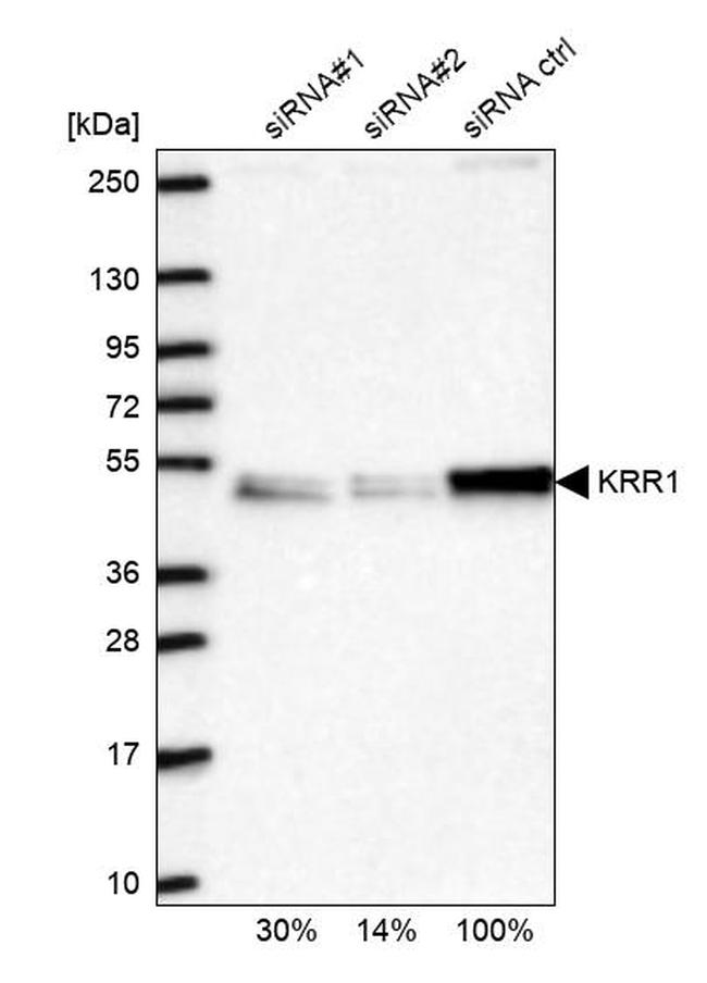 KRR1 Antibody in Western Blot (WB)