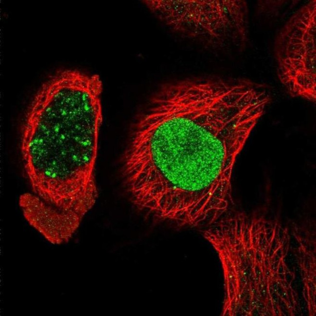 KCTD13 Antibody in Immunocytochemistry (ICC/IF)