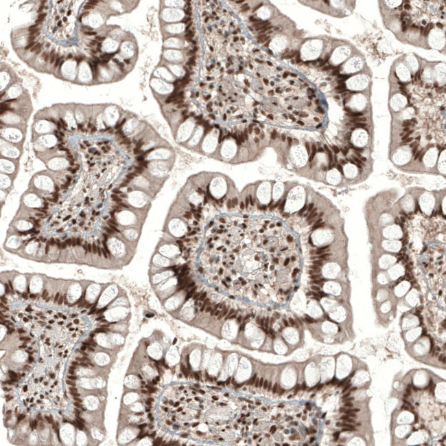 KCTD13 Antibody in Immunohistochemistry (IHC)