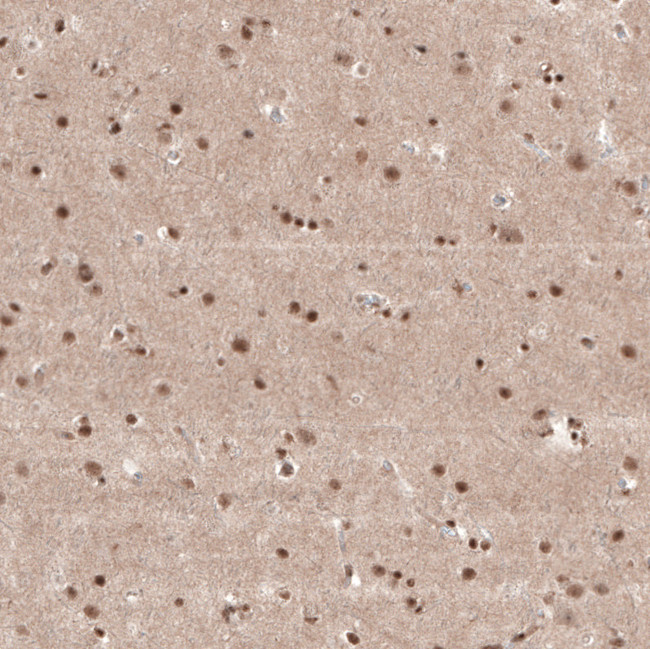 KCTD13 Antibody in Immunohistochemistry (IHC)