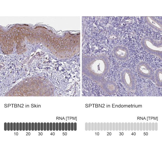 Spectrin beta-3 Antibody in Immunohistochemistry (IHC)