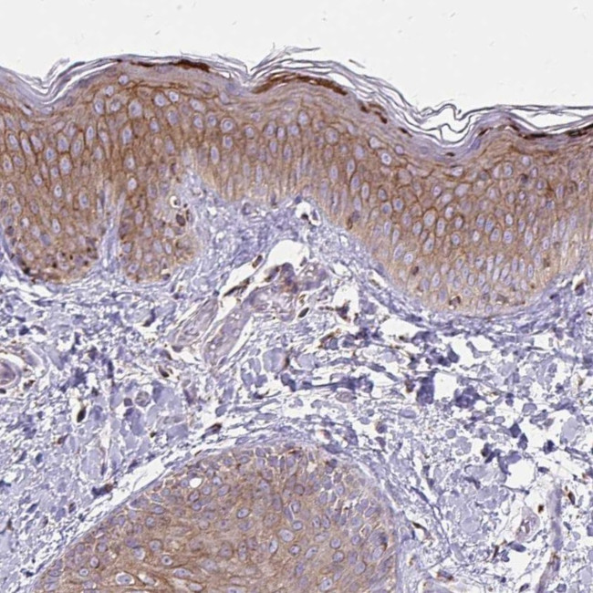 Spectrin beta-3 Antibody in Immunohistochemistry (IHC)