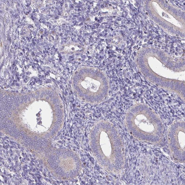 Spectrin beta-3 Antibody in Immunohistochemistry (IHC)