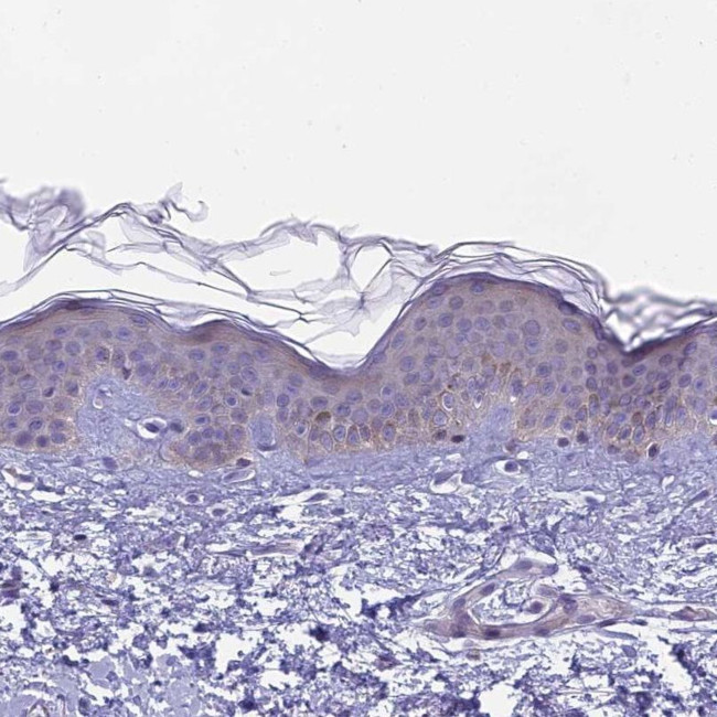 ARHGEF37 Antibody in Immunohistochemistry (IHC)