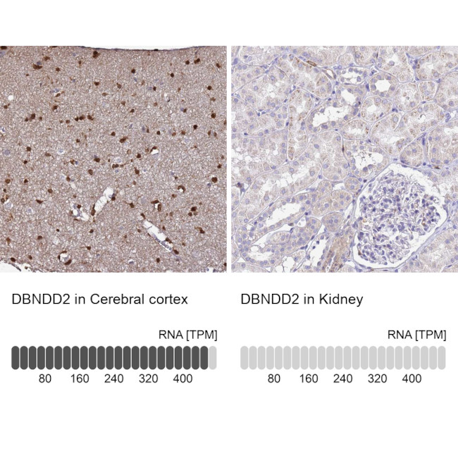 DBNDD2 Antibody in Immunohistochemistry (IHC)