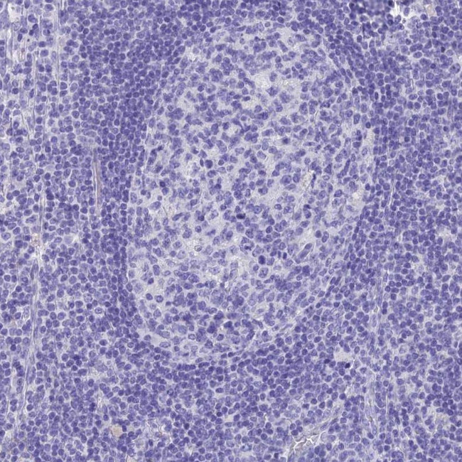 SLC36A2 Antibody in Immunohistochemistry (IHC)